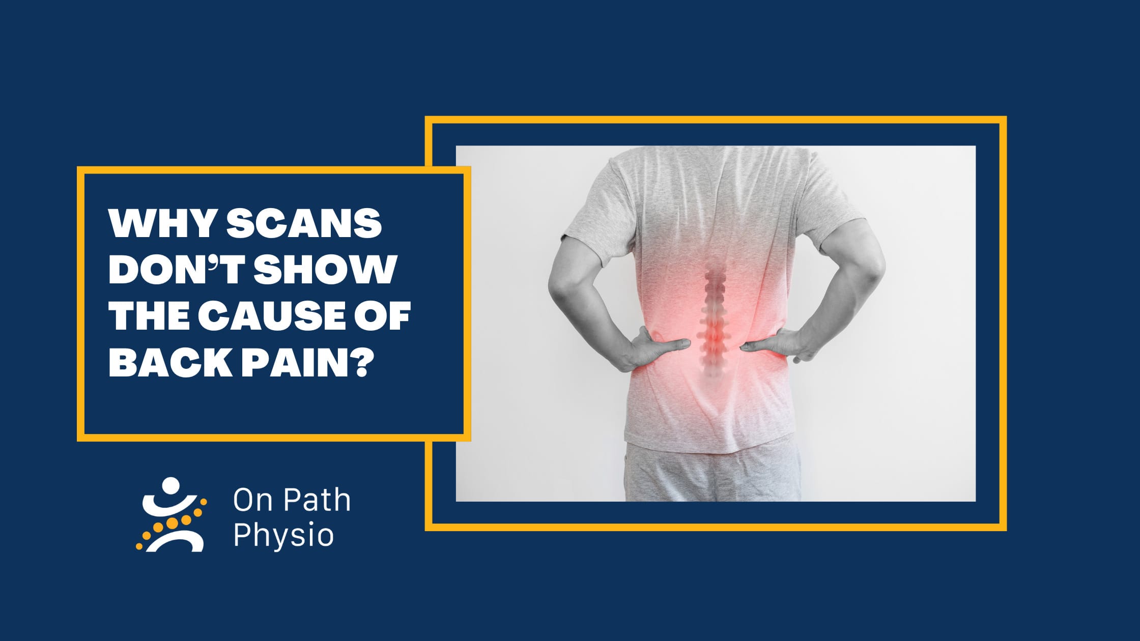why scans don't show the cause of lower back pain